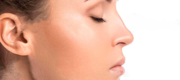 Rinoplastia - Imagen 4